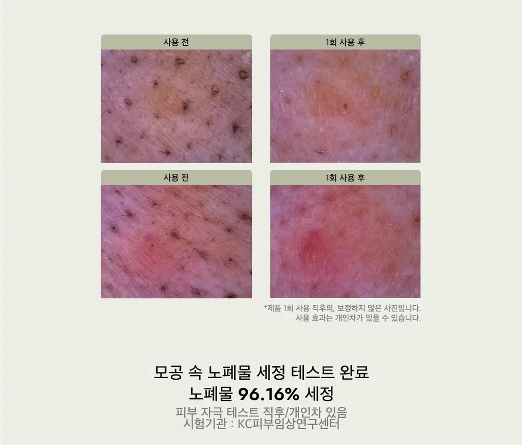 [단독기획] 라씨엘르 곡물 클렌징오일 200ml 기획 (+파우더워시 10g) 상세페이지 19